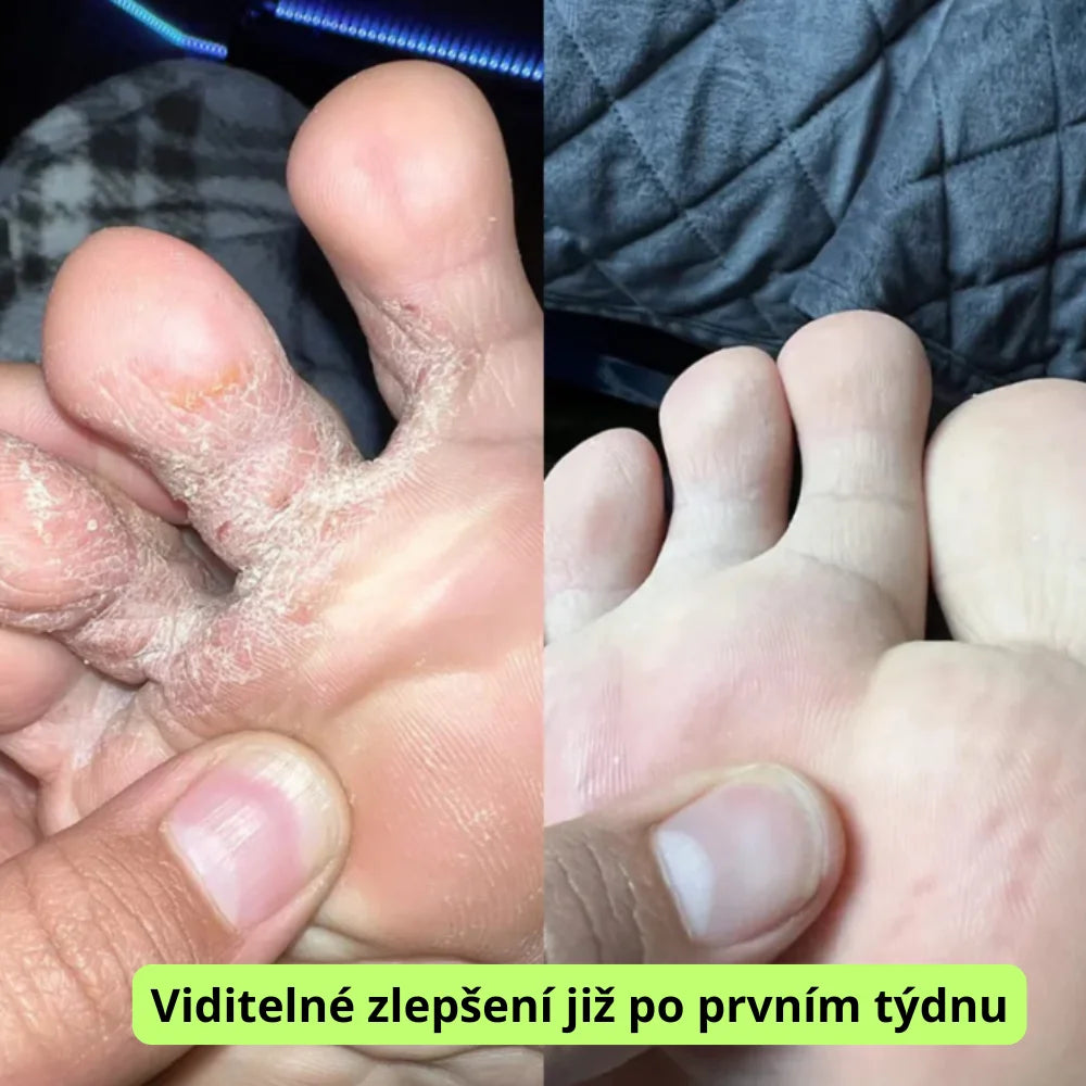 PureMýdlo® Čisticí antifungální mýdlo